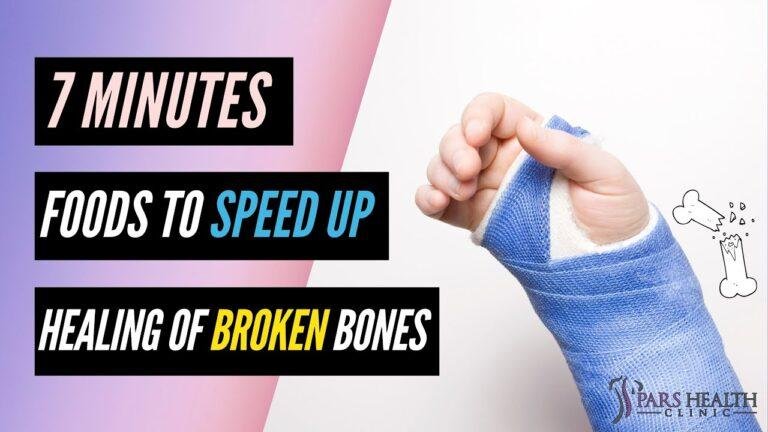 Eat These Foods to Speed up Healing of Broken Bones