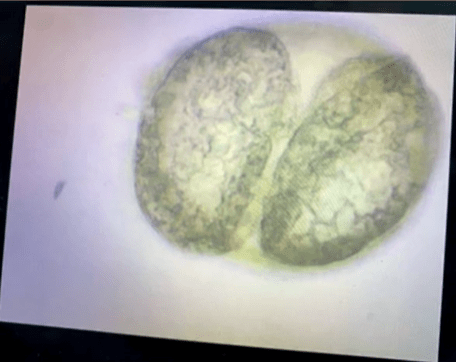 Microscopy: Organisms, Graphene Oxide And 'nanotech In Action' In Vaccine Vials - Dr. Carrie Madej Advanced Medicine Conference 2022 | Holistic Health Online