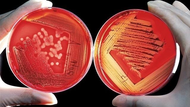 TAU Develops world's first mRNA vaccine for deadly bacteria - Jewish Business News