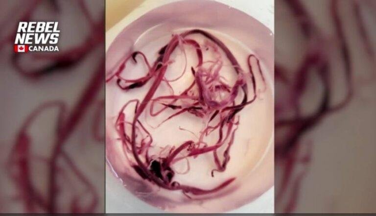 Canadian Funeral Director and Embalmer Testifies About “Dirty Blood” Found in Bodies Post COVID Vaccinations