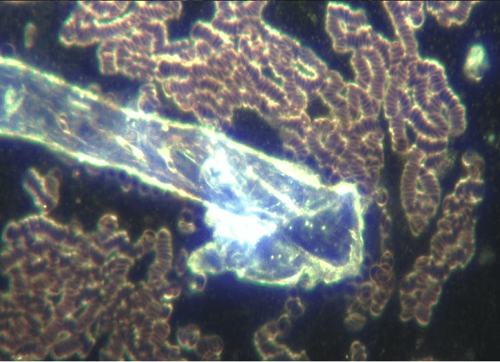 Decontaminating The Blood From Synthetic Biology With EDTA (microscopy) | Holistic Health Online