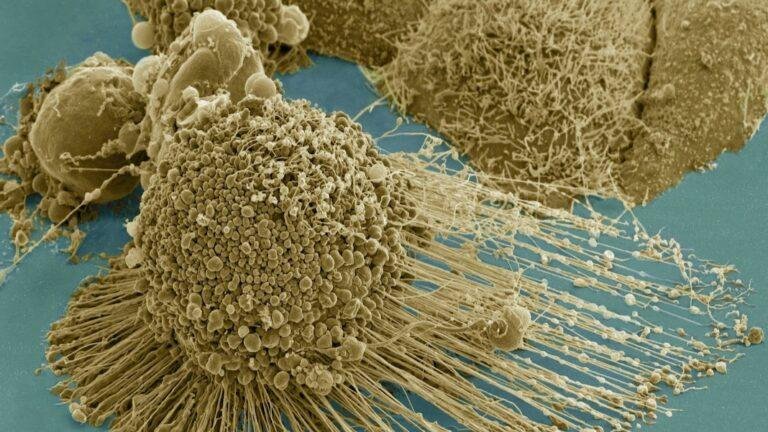 Zombie Cells Have a Weakness. An Experimental Anti-Aging Therapy Exploits It.