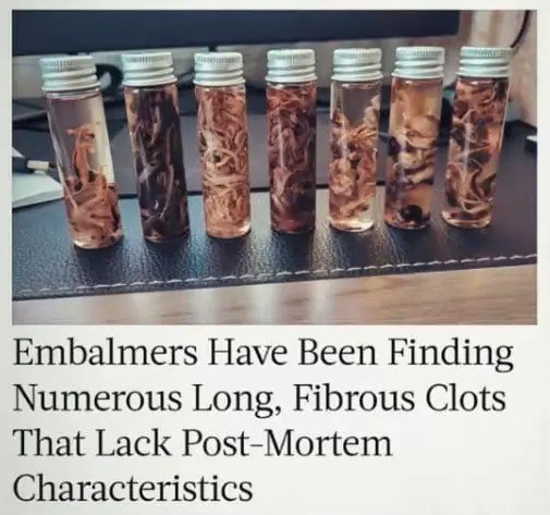 Embalmers: Important Information About Fibrous Clots In Arteries/veins | Holistic Health Online
