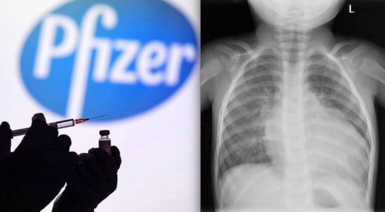 SCANDALl! Pfizer Knew very Soon that its Covid mRNA Vaccine caused Heart Damage on Kids. But has Used them as Guinea-Pig